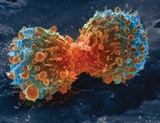 Ingredient in Olive Oil Kills Cancer Cells